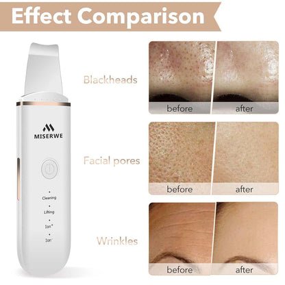 Skin Scrubber